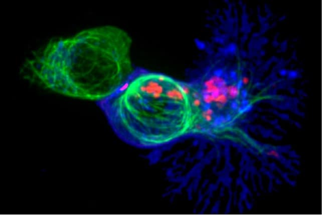 Killer T cell hunting a target cell.