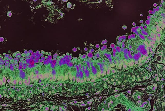 Color-enhanced goblet cells (dark purple) in lung epithelium.