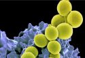 Staphylococcus aureus bacteria.