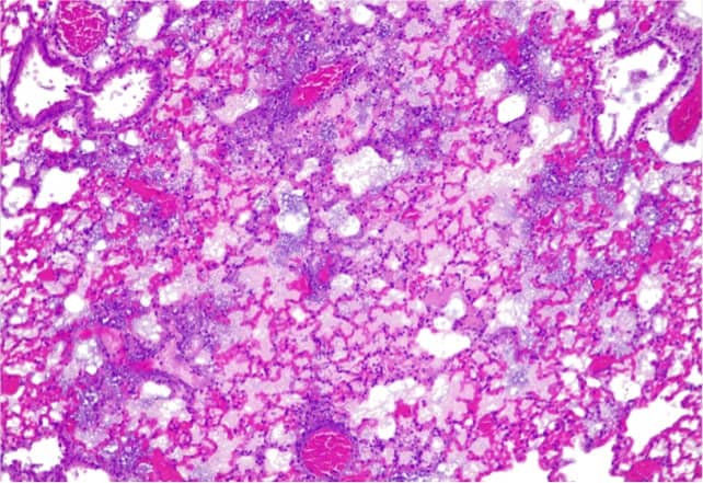 Mouse lungs with acute drug-resistant infection.