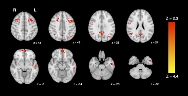 Brain fMRI.