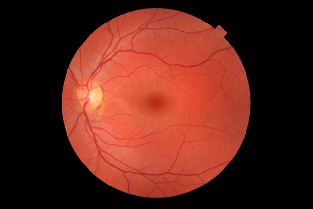 Retinal scans: A non-invasive, inexpensive method to track human aging