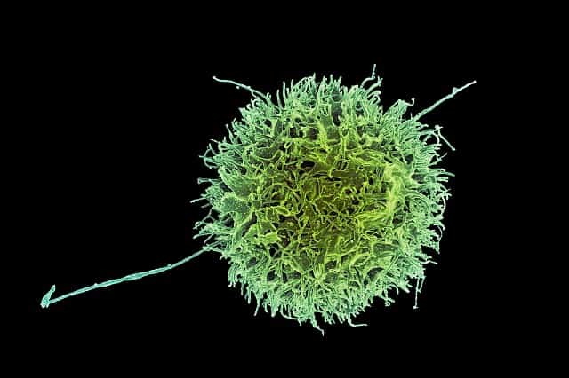 Colorized scanning electron micrograph of a natural killer cell from a human donor.