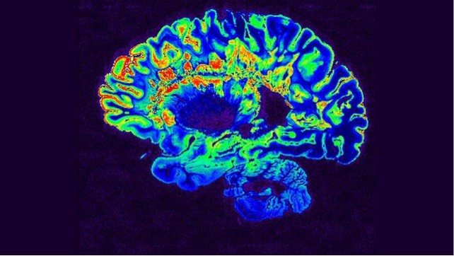 MRI image of human brain.
