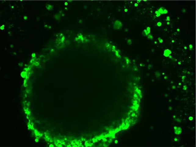Researchers show how a tumor cell’s location and environment affect its identity