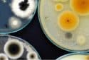 Bacteria in a petri dish.