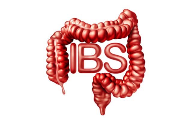 Irritable bowel syndrome (IBS) concept.
