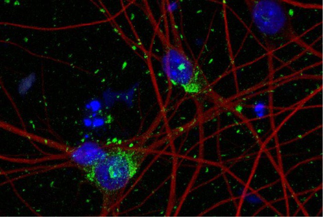 Staining of human stem-cell derived neurons
