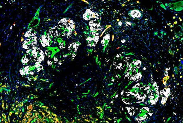 Stained pancreatic islet graft.