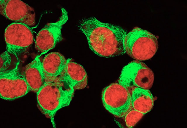 Fluorescent microscopy images of cultured human neuroblastoma cells.