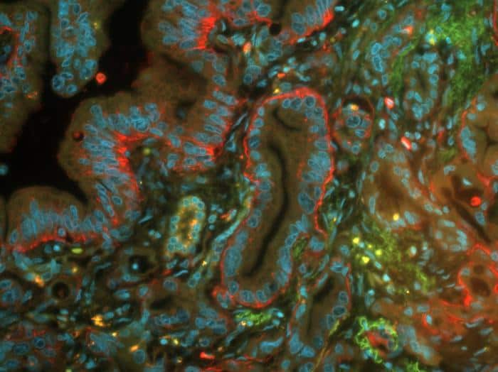 Human pancreatic cells.