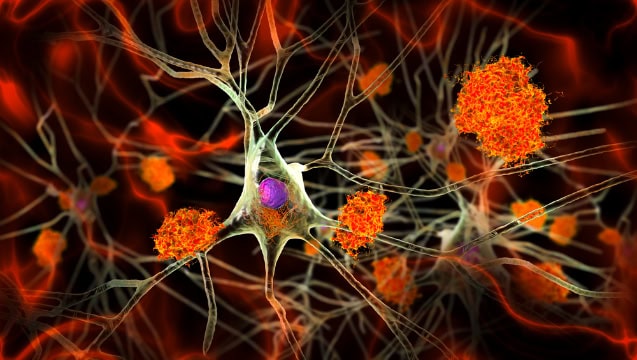 Alzheimer’s disrupts circadian rhythms of plaque-clearing brain cells ...