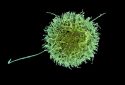 Natural killer cell.