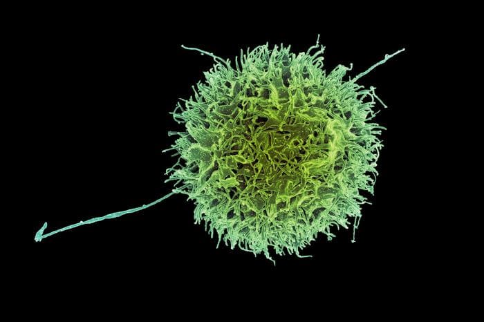 Natural killer cell.