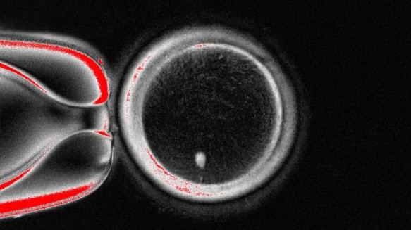 Oocyte with skin cell nucleus.