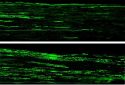 Regeneration of nerve fibers.