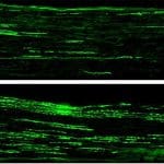 Regeneration of nerve fibers.