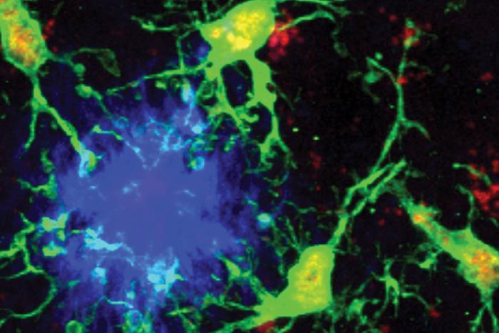 Protective microglia attack plaques in mouse brain.