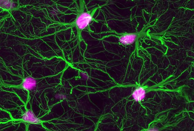 Astrocytes, brain support cells.