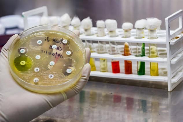 Culture plate of bacterial growth with sensitivity to different antibiotics.