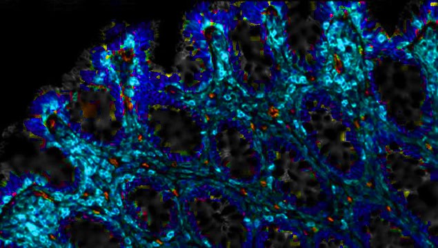 Human intestinal ephitelium.