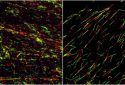 ATR inhibition disrupts replication fork progression.