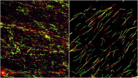 ATR inhibition disrupts replication fork progression.
