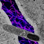 Turicibacter graphic