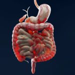 Inflamed large intestine, Crohn's disease, digestive system.