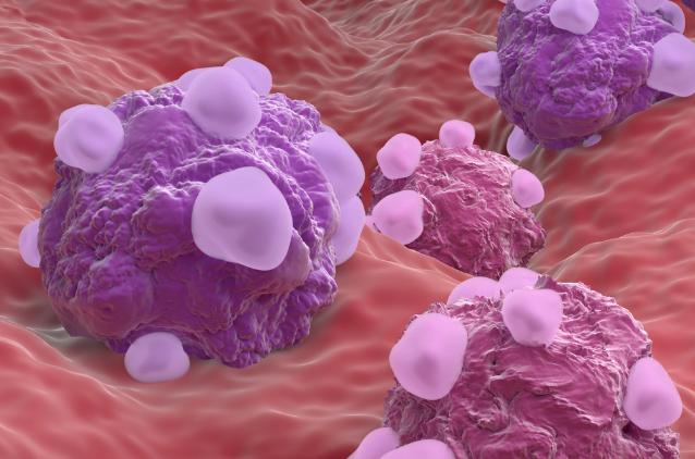 Cancer cells, illustration.
