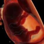 Human embryo around 11 weeks of gestation.