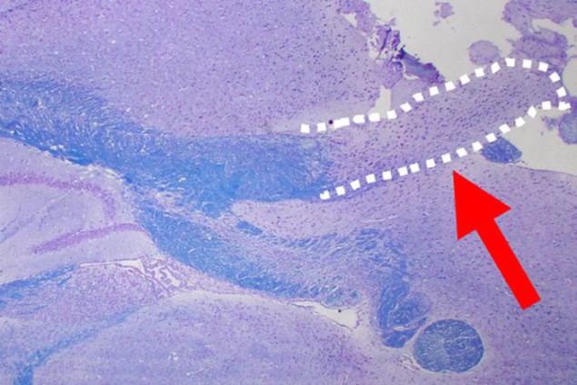 Missing corpus callosum in mouse brain.
