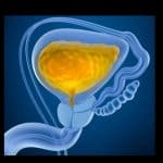 Urinary bladder with urine, illustration.