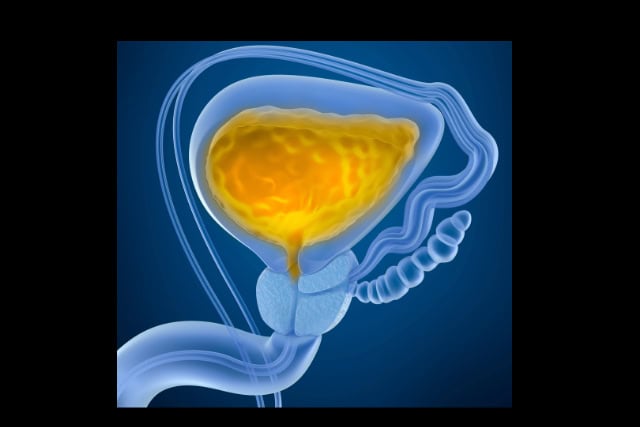 Urinary bladder with urine, illustration.