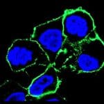 Antibody-drug conjugate (green) precisely targets fusion-driven cancer cells (blue).