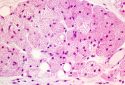 Brown adipocytes.