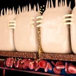 Leaky gut illustration.