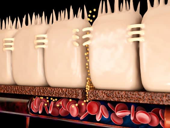 Leaky gut illustration.
