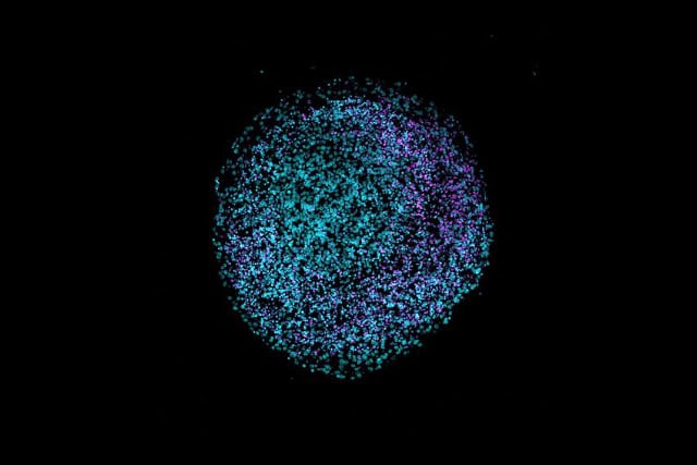 Human brain organoid cryosection.