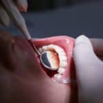 Dental exam.