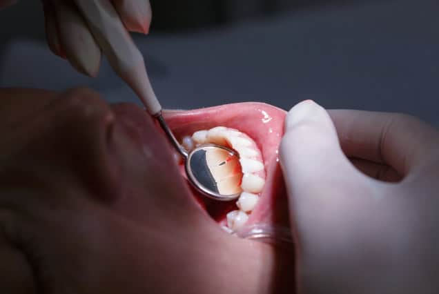 Dental exam.