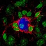 Microglia
