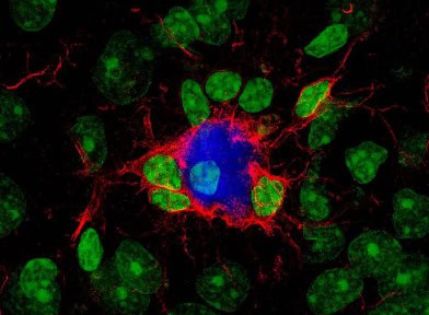 Microglia
