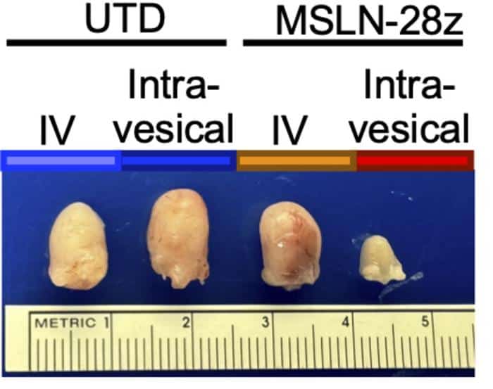 CAR T cells reduce bladder tumor size.
