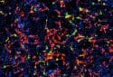 Multiplex immunofluorescence image of a mouse prostate tumor.