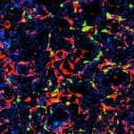 Multiplex immunofluorescence image of a mouse prostate tumor.