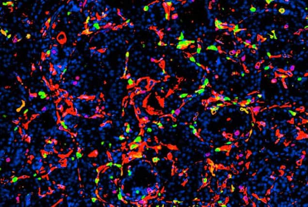 Multiplex immunofluorescence image of a mouse prostate tumor.