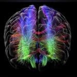 Brain graph.