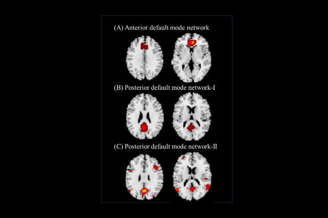 Brain mri images.