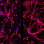 Healthy (right) and deteriorated (left) human retinal endothelial cells.